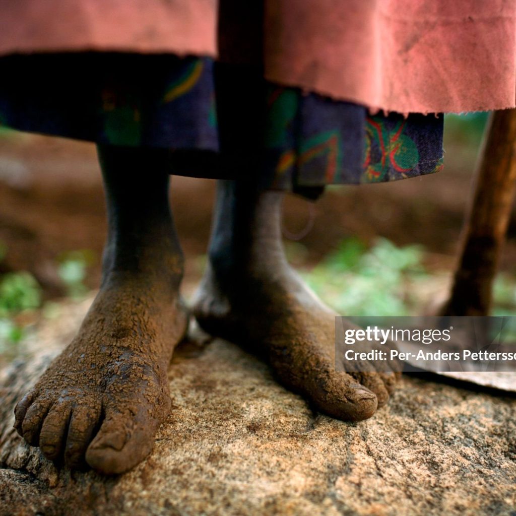 gettyimages 57522038 2048x2048